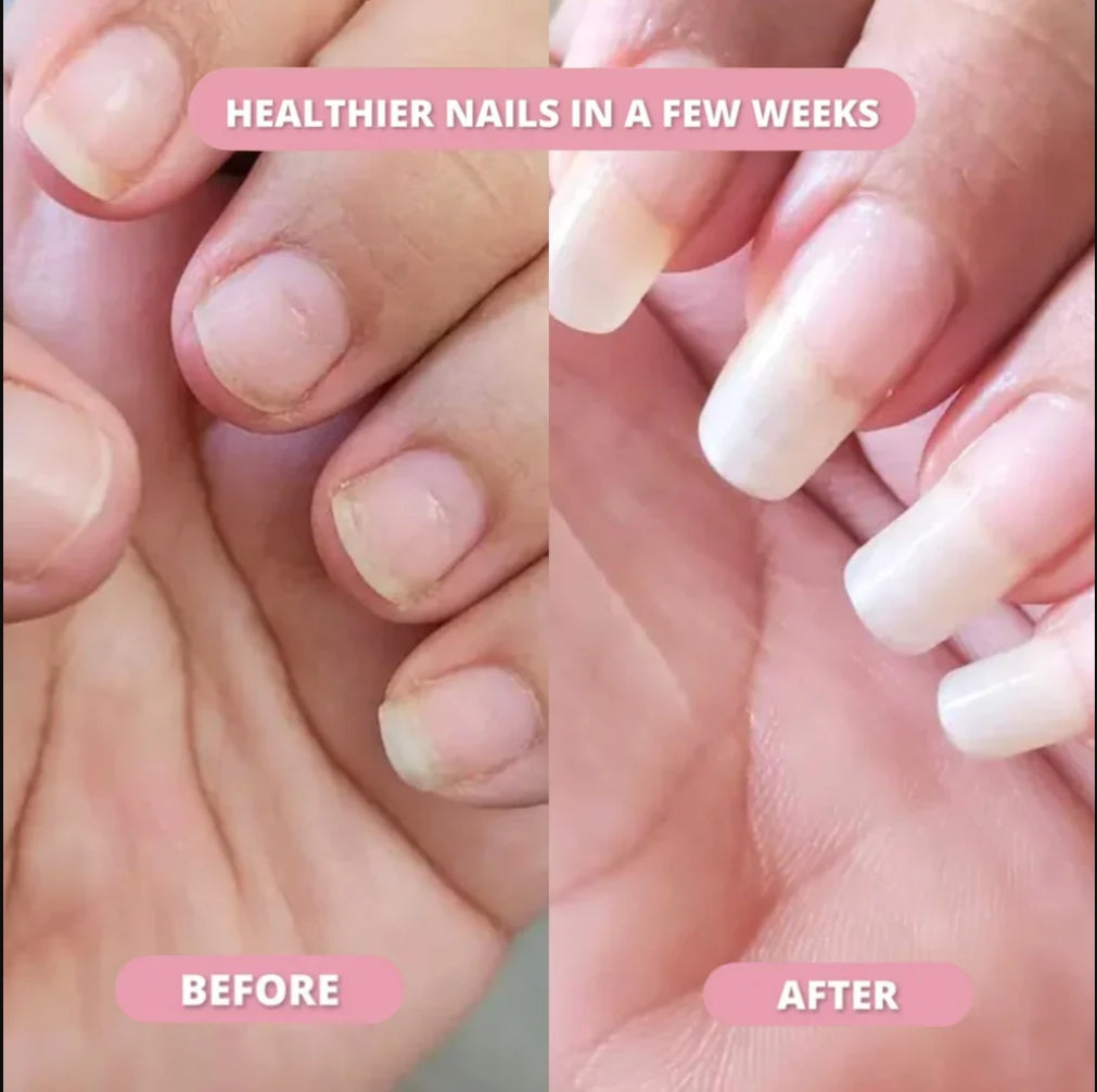 NAIL GROWTH OIL