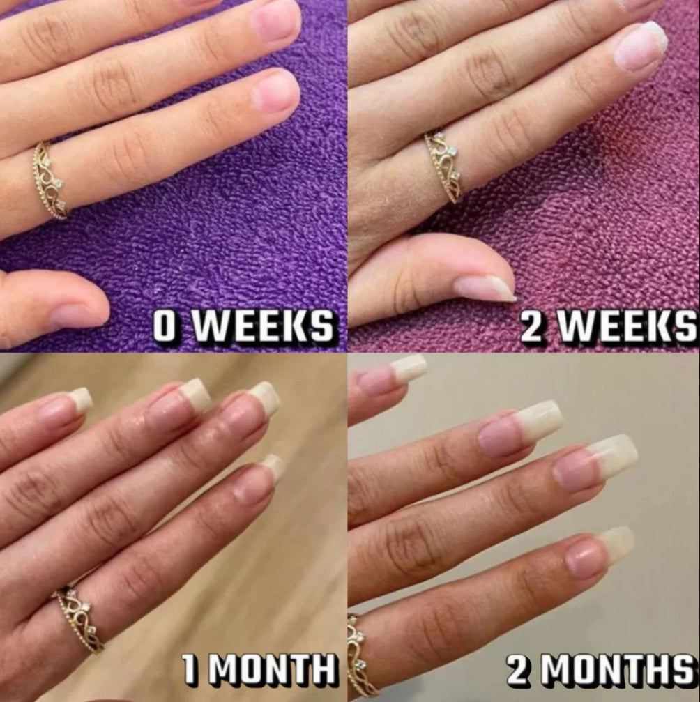 NAIL GROWTH OIL